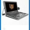 ecograf-portabil-doppler-color-vinno-a5-1_BeneficStarMed ecograf-portabil-doppler-color-vinno-a5-1_BeneficStarMed