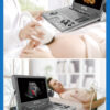 ecograf-portabil-doppler-color-vinno-a5-2_BeneficStarMed ecograf-portabil-doppler-color-vinno-a5-2_BeneficStarMed