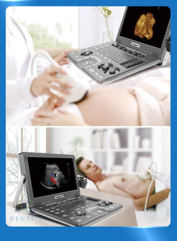 ecograf-portabil-doppler-color-vinno-a5-2_BeneficStarMed ecograf-portabil-doppler-color-vinno-a5-2_BeneficStarMed