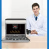 ecograf-portabil-doppler-color-vinno-a5-3_BeneficStarMed ecograf-portabil-doppler-color-vinno-a5-3_BeneficStarMed