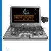 ecograf-portabil-doppler-color-vinno-a5_BeneficStarMed